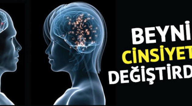 Beynin "cinsiyeti" değiştirildi