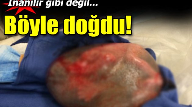 Mucize! Böyle dünya geldi