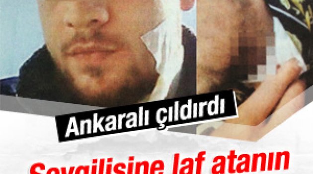 Psikoloji bozuk kişi sevgilisine laf atan adamı ısırdı